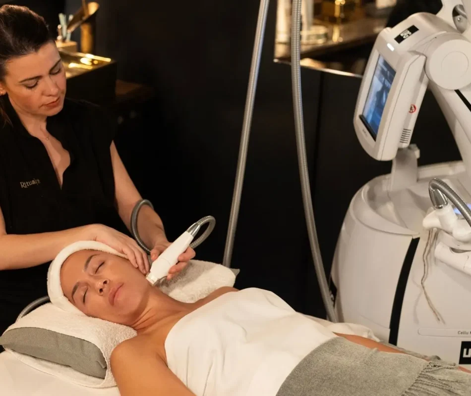 tratamiento lpg facial madrid