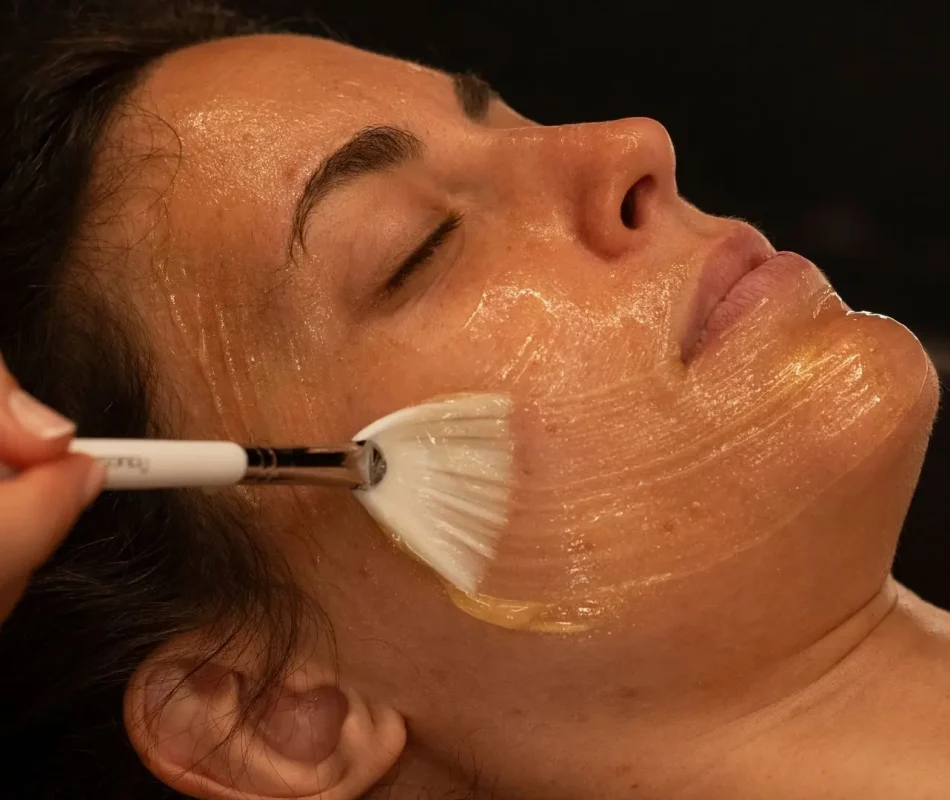 vitaminac-tratamiento-centro-estetica